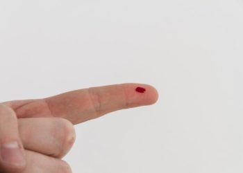 Najis Tidaklah Membatalkan Wudhu?