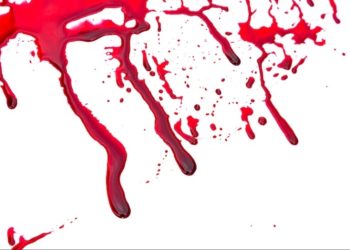 Apakah Noda Darah Haid Termasuk Najis? Muslimah Perlu Memahami Cara Tepat Untuk Menyucikannya!